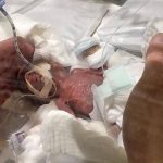 Smallest baby released healthy