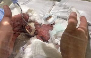 Smallest baby released healthy